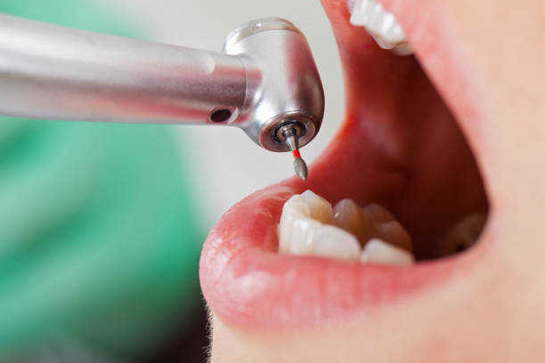 Best Mobile Emergency Dentist in Bay City, MI